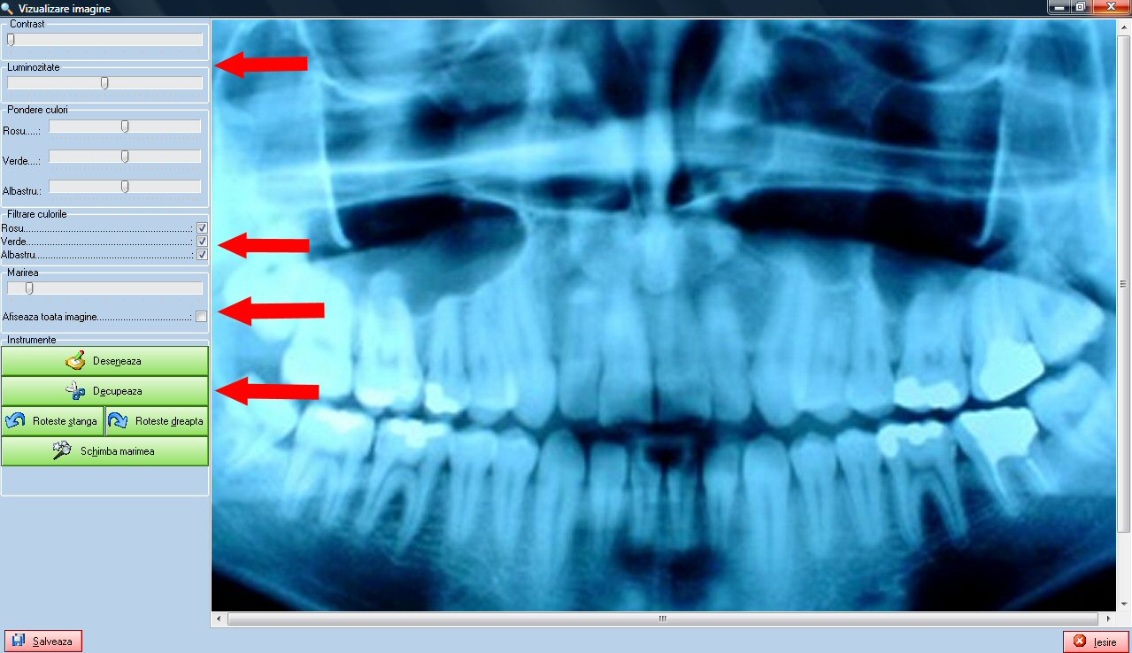 Vizualizarea radiografiilor si modificarea contrastului si luminozitatii